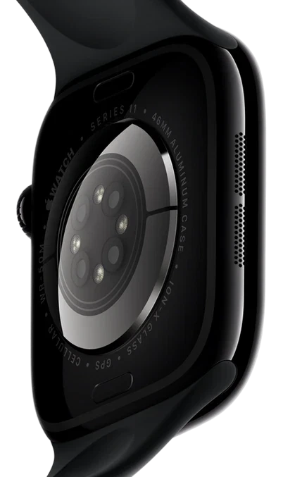 Apple Watch 11